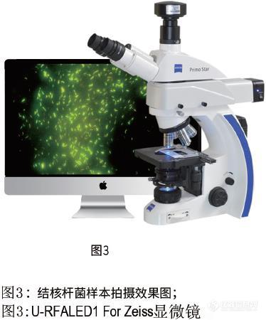 结核杆菌效果图