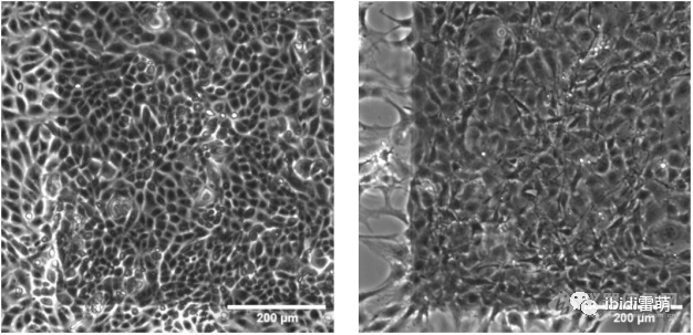 ibiPore可视化的Transwell:可实时观察流动、剪切力作用下细胞迁移、侵袭、细胞间相互作用