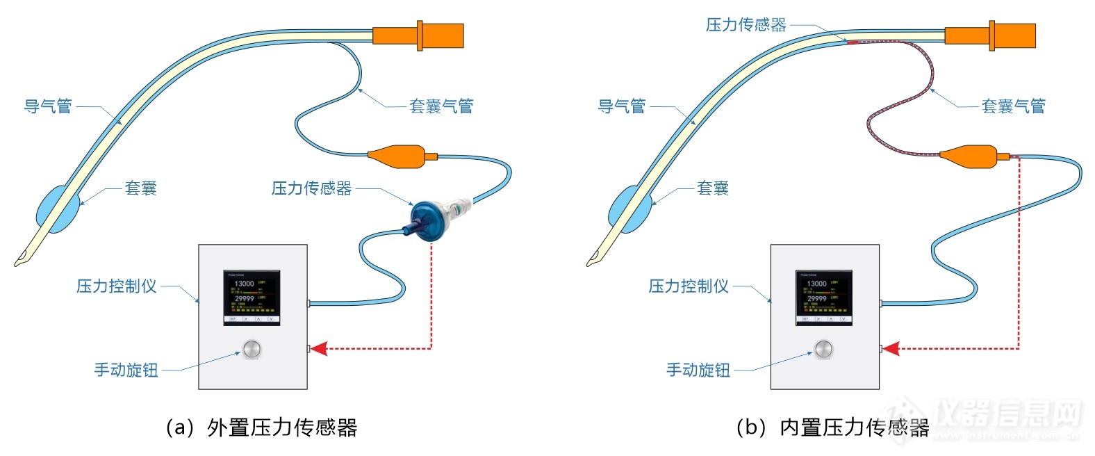 02.两种形式气管导管套囊的自动压力控制结构示意图.jpg