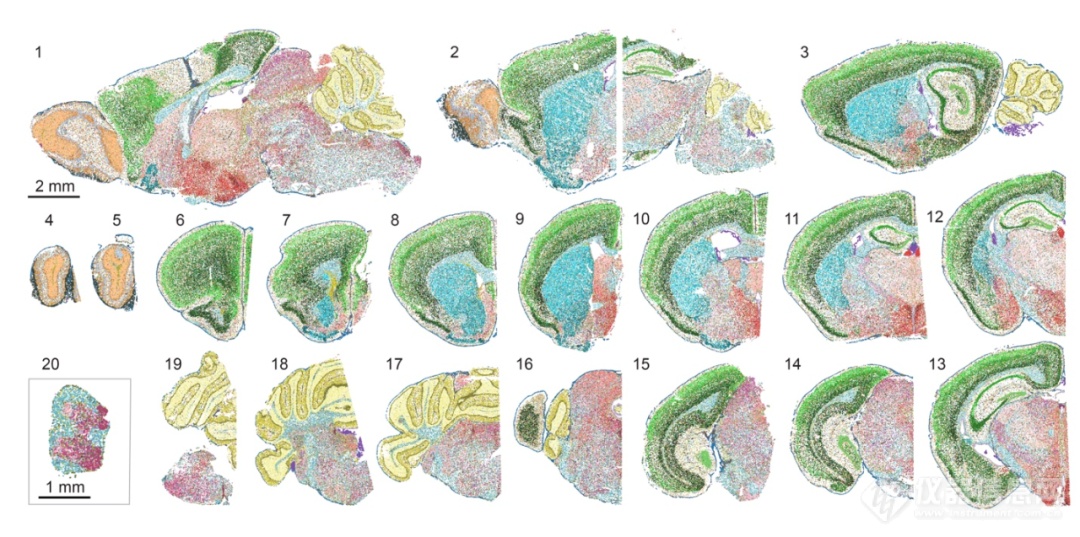 Nature：王潇/刘嘉团队绘制大脑高分辨率单细胞空间转录组图谱