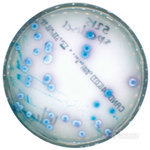 scan_chromogenicpetridish_web-a0fe6.jpg