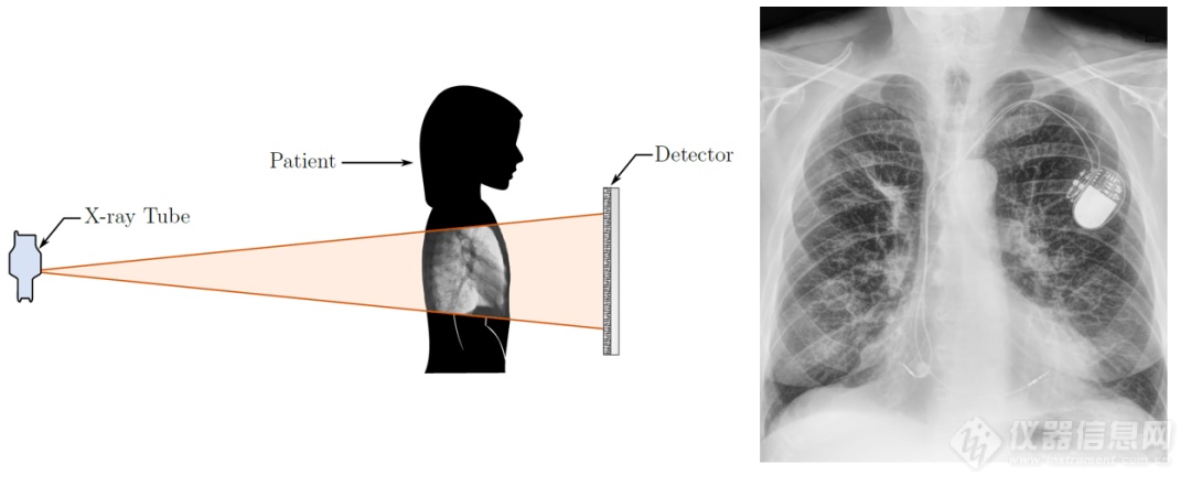双能量X射线成像技术的发展