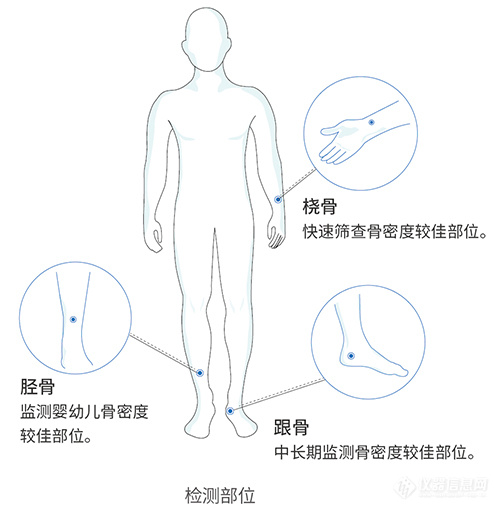 超声骨密度仪OSTEOKJ3700S应用领域