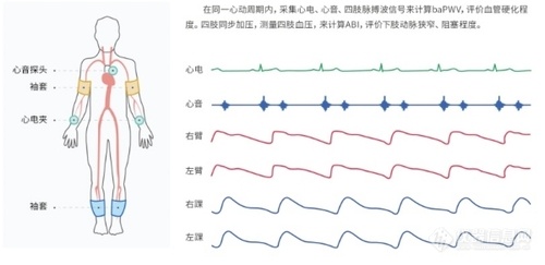 动脉硬化检测仪检查部位