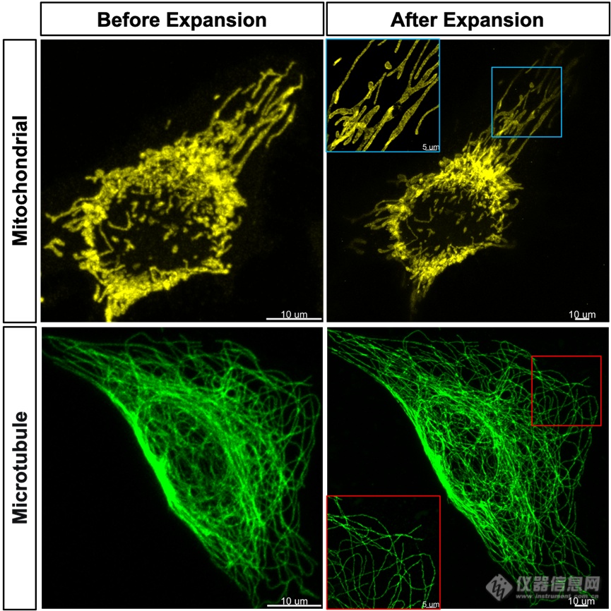 Hela 细胞采用Mito-tracer（黄色）和β-tubulin（绿色）分别标记线粒体和微管并采用细胞膨胀试剂盒进行制样，激光共聚焦显微镜成像膨胀前后对比结果。.png