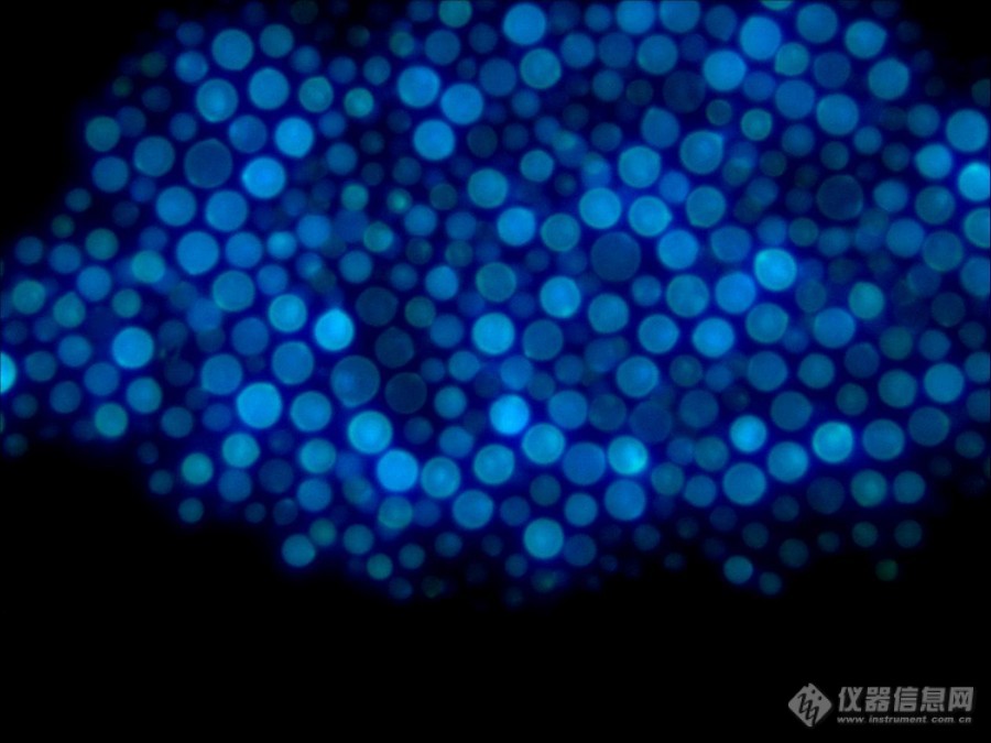 03_荧光显微镜下的新生隐球菌.jpg