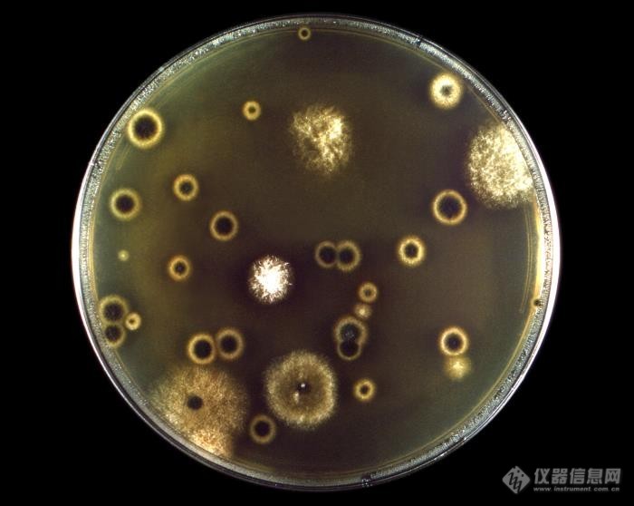 01_荧光显微镜下的新生隐球菌.jpg