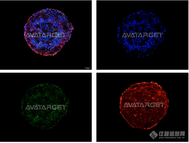 智能成像+AI算法|艾玮得生物发布AvatarInsight高内涵智能成像分析仪新品