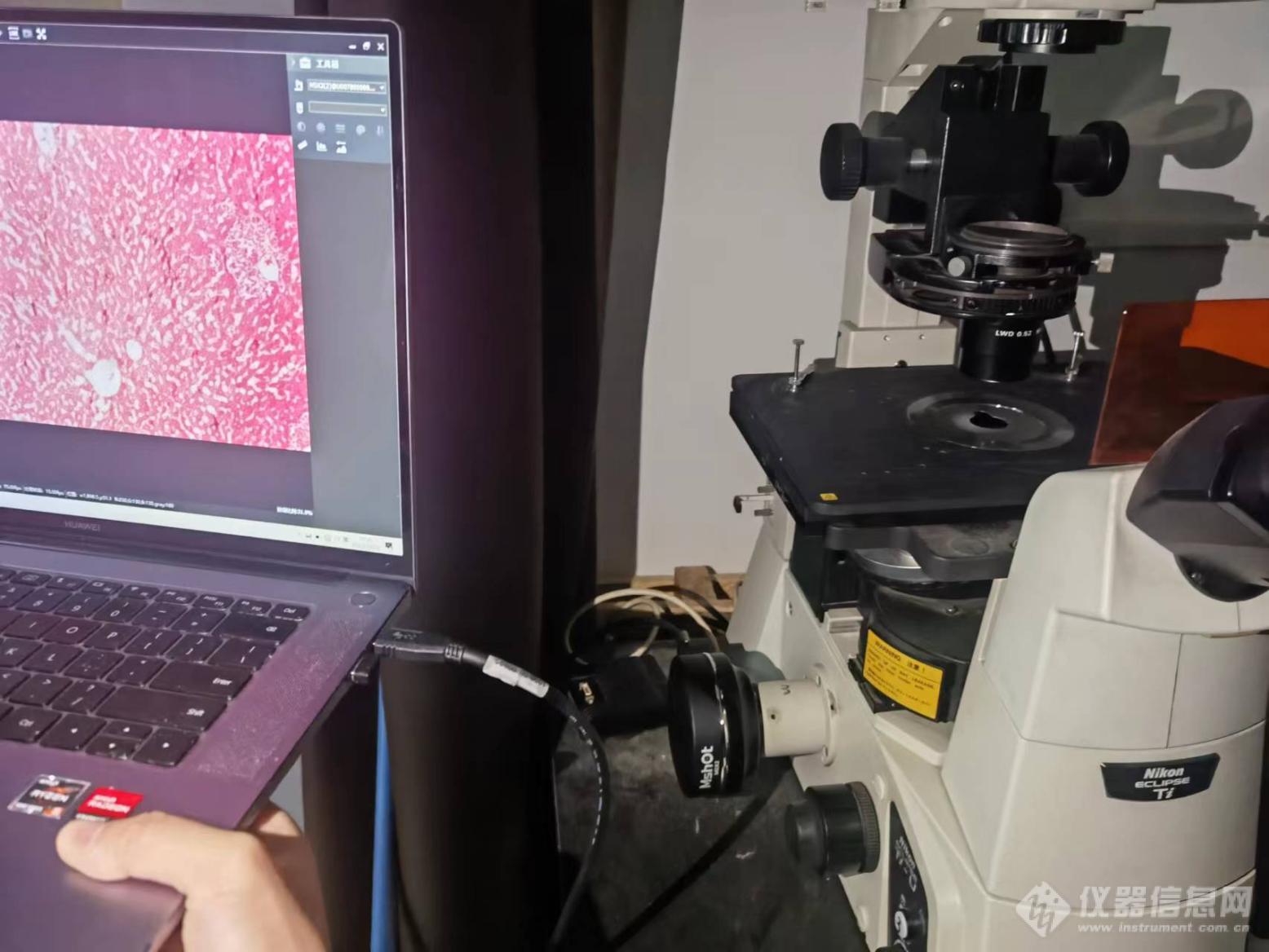03_倒置荧光显微镜应用于鼠肝观察.jpg