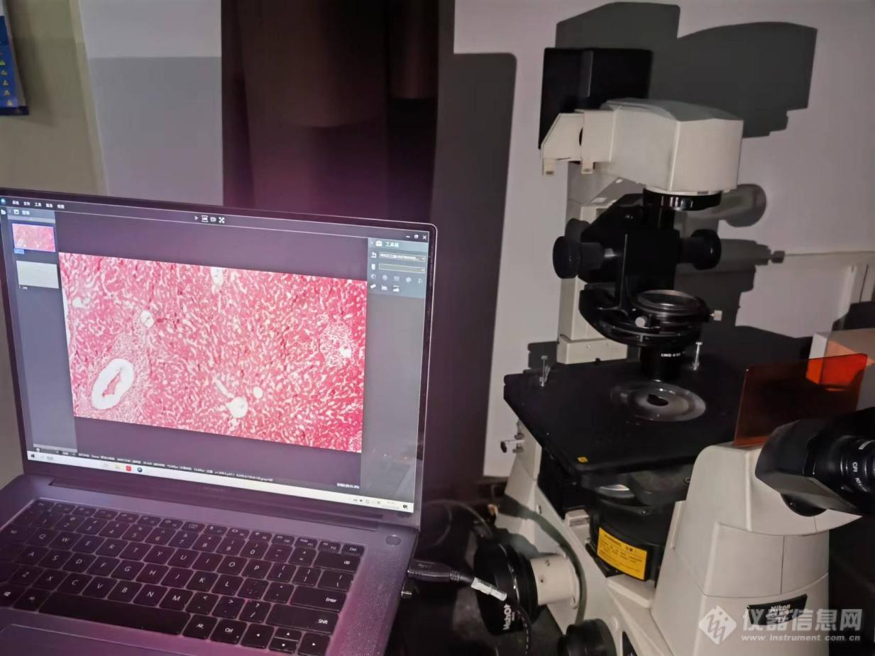 02_倒置荧光显微镜应用于鼠肝观察.jpg