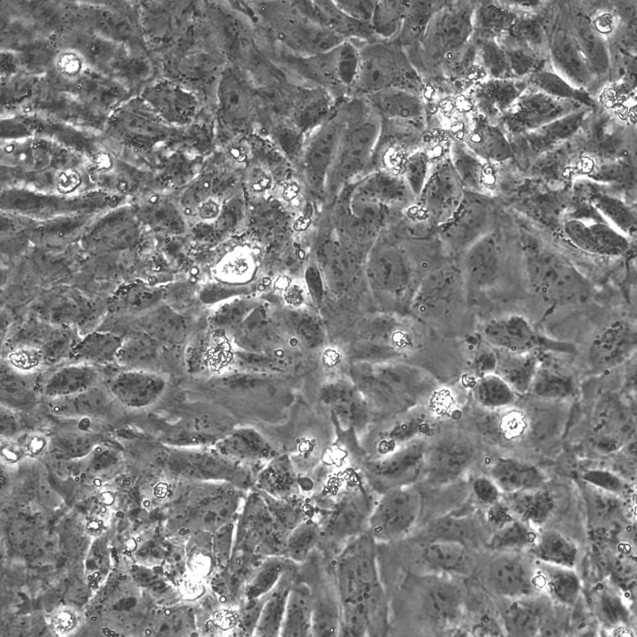 VercellTM- Cardiomyocytes人源心肌细胞