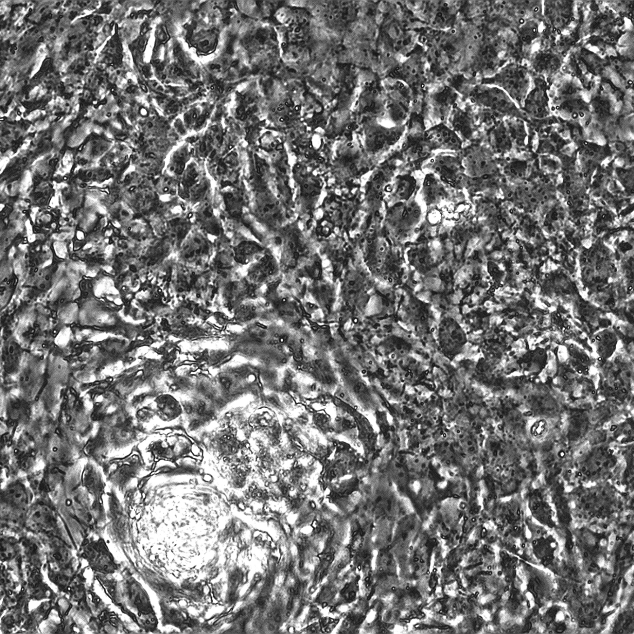 VercellTM- Cardiomyocytes人源心肌细胞