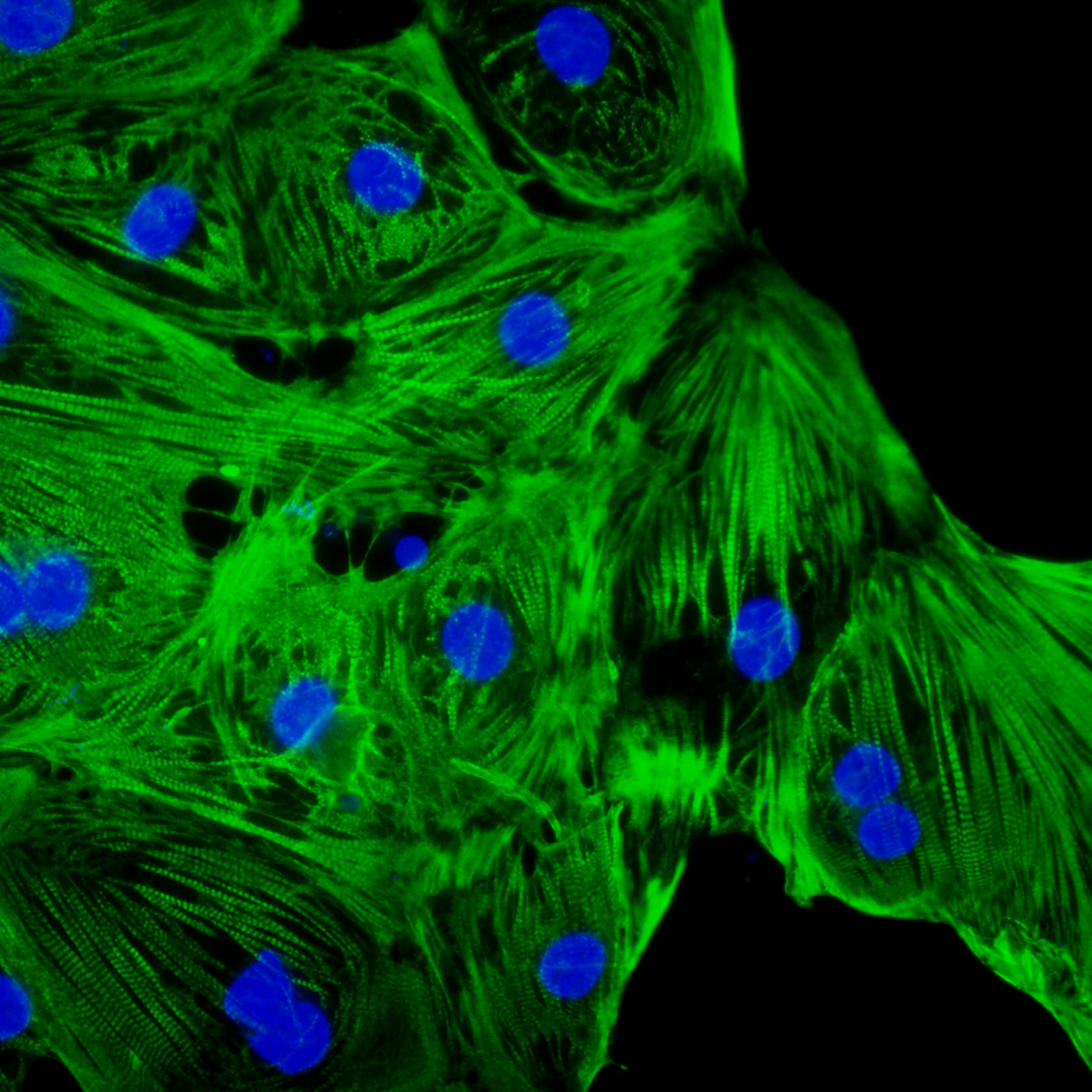 VercellTM- Cardiomyocytes人源心肌细胞