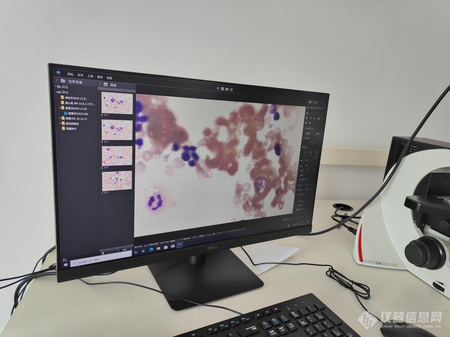 显微镜相机应用于血涂片观察