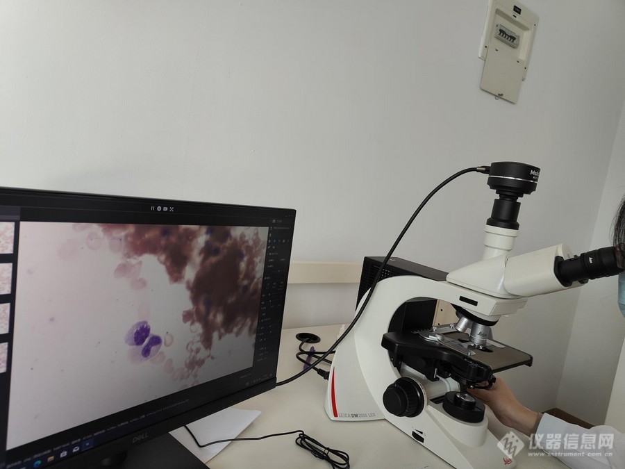 02_显微镜相机应用于血涂片观察.jpg