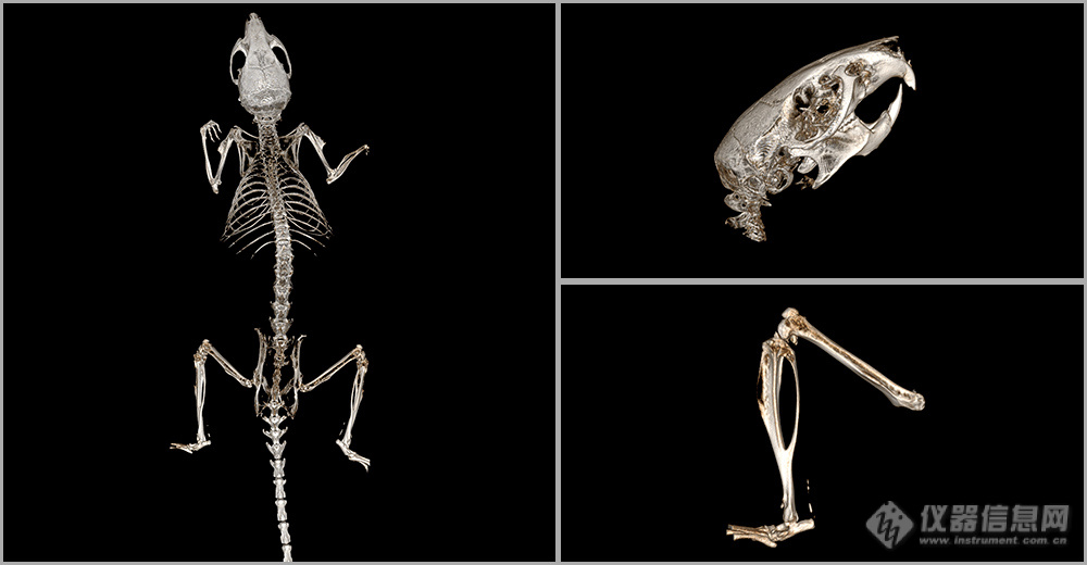 骨骼CT.jpg