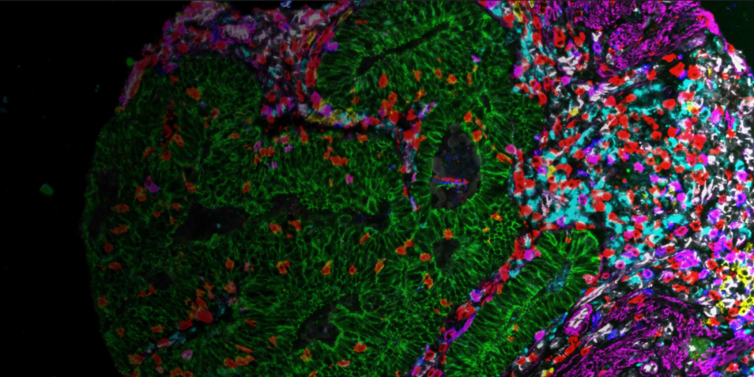 【网络研讨会】利用Cell DIVE 在单细胞水平上进行超复杂癌症组织分析