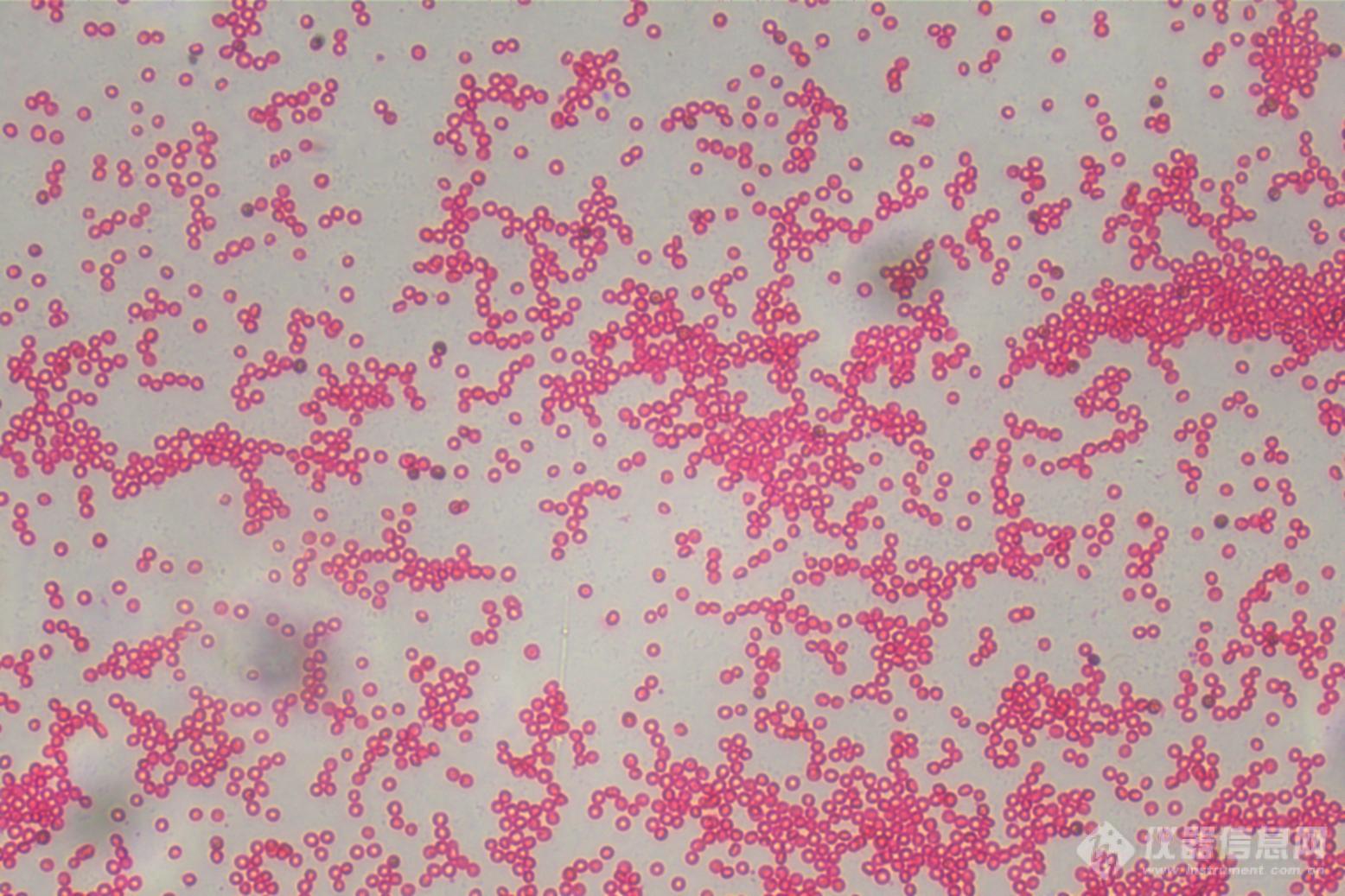 01_倒置显微镜下的红细胞.jpg