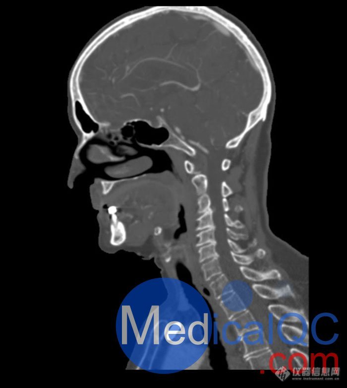 WEK51-02 CT血管造影头模,WEK51-02 CTA头部模型成像效果图