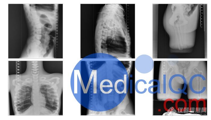 CT-A01成人躯干模体,CT-A01成人躯干模型X射线成像效果