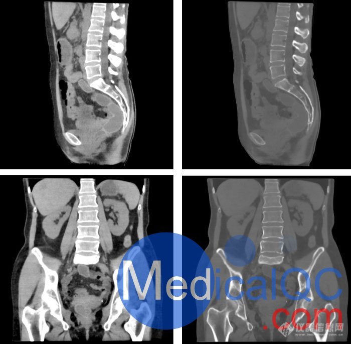 WEK55-02腹部骨盆模体，WEK55-02腹部骨盆模型