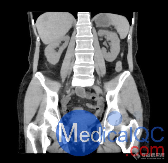 WEK55-02腹部骨盆模体，WEK55-02腹部骨盆模型成像效果图