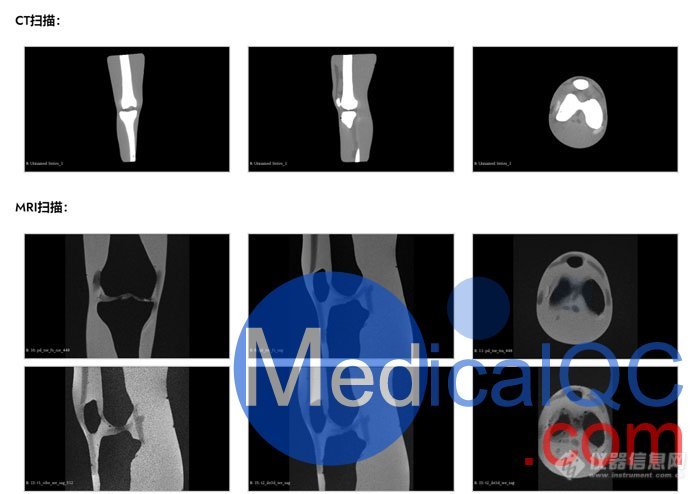KE-A03成人膝关节，KE-A03膝关节模体,KE-A03膝关节模型成像效果图
