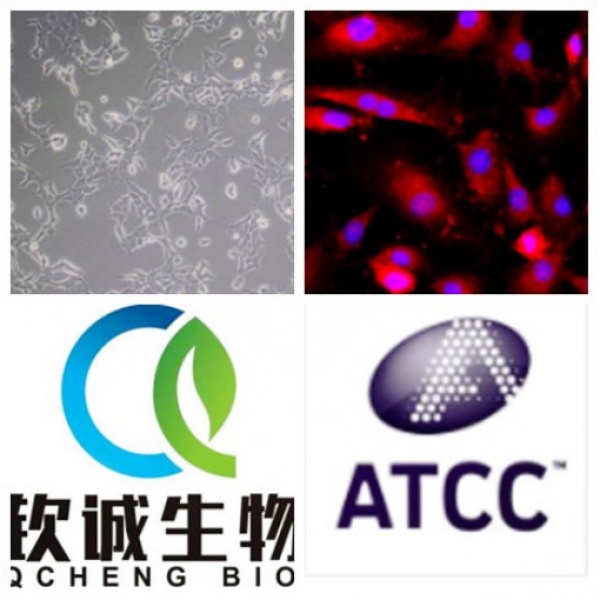 HCC1143 人乳腺癌细胞（三阴性）QCH858