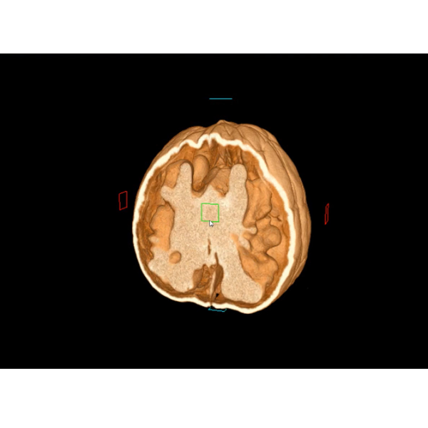 NAOMI-CT纳奥美光学桌面级工业CT