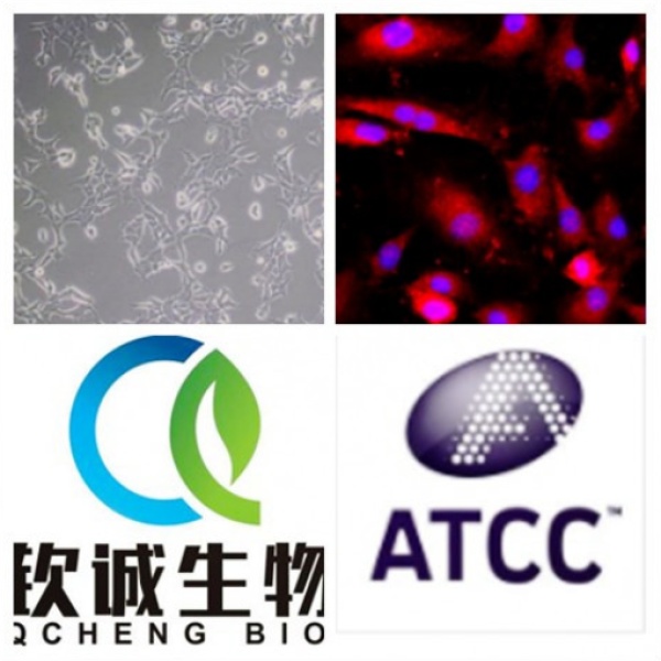 HCC1171 人肺癌腺癌贴壁细胞QCH855