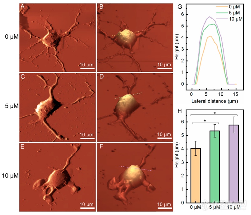 ACS Nano：Aβ42寡聚体与海马体神经元细胞作用机制
