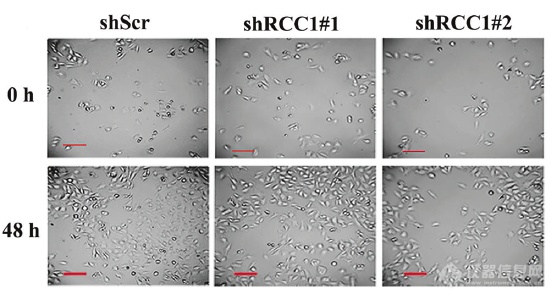 zenCELL owl活细胞动态成像系统用于软组织肉瘤RCC1-Skp2核质转运的调控研究