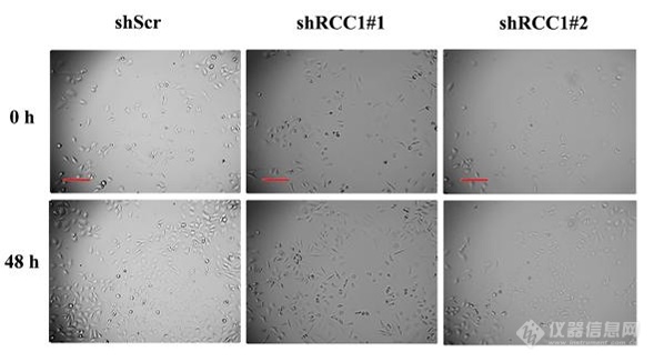 zenCELL owl活细胞动态成像系统用于软组织肉瘤RCC1-Skp2核质转运的调控研究