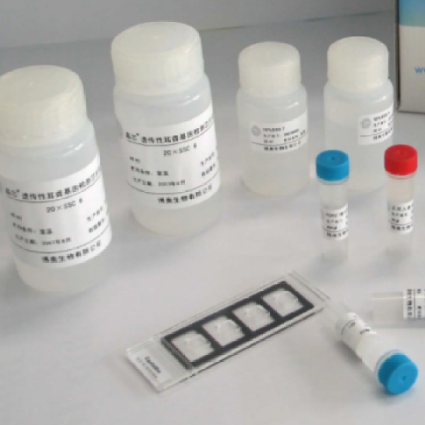 人S100钙结合蛋白A8/A9复合物(S100A8/A9)Elisa试剂盒