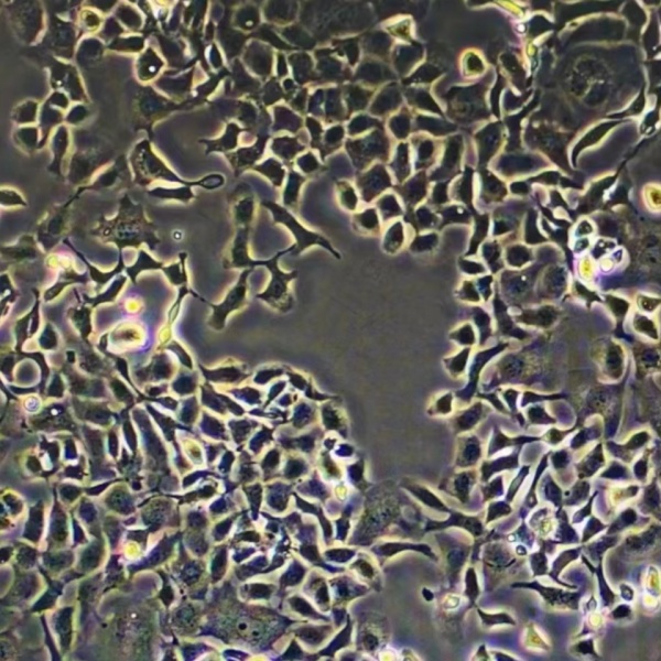 人肾母细胞瘤细胞SK-WEP-1