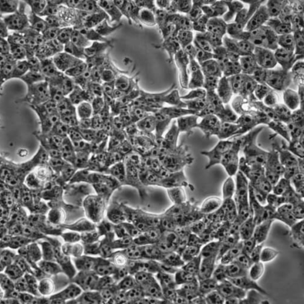 小鼠膀胱癌细胞荧光素酶MB49/LUC