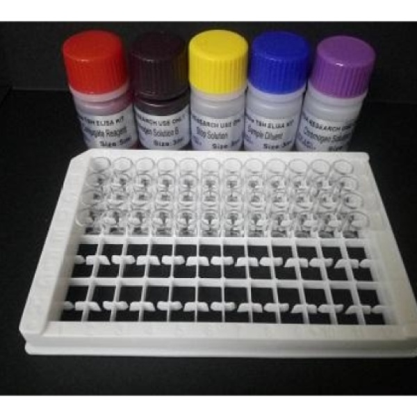 小鼠α1酸性糖蛋白(α1-AGP)Elisa试剂盒