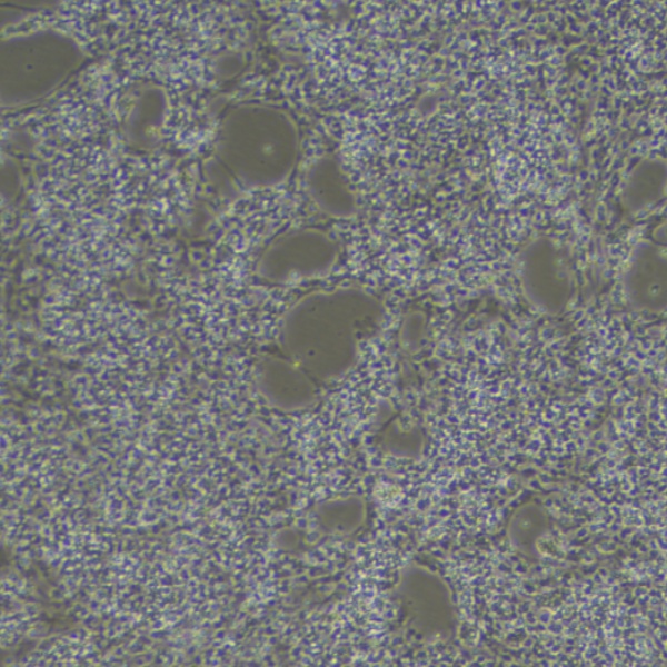 人成纤维细胞GM09326
