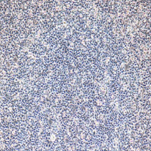人胶质母细胞瘤细胞A172 