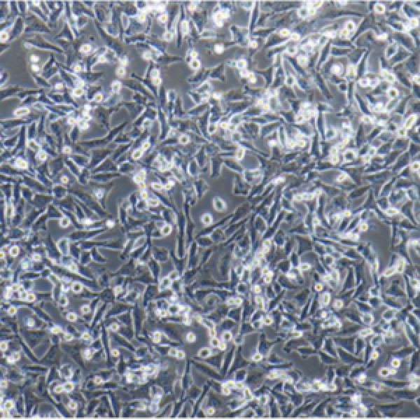 人纤维肉瘤细胞HT-1080+CXCR4(h)-Puro