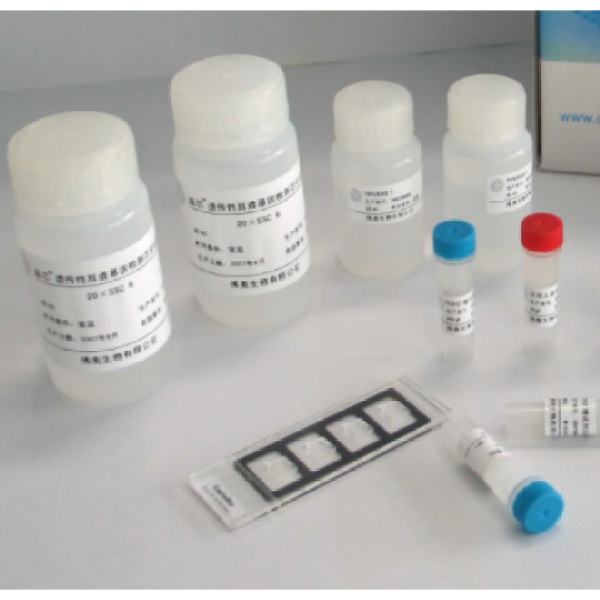 人副流感病毒1型(PIV-1)Elisa试剂盒
