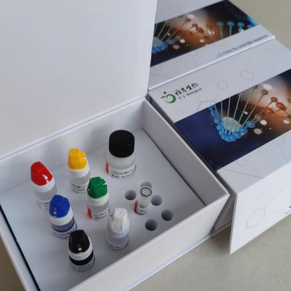 人免疫球蛋白重链可变区(IgHV)Elisa试剂盒