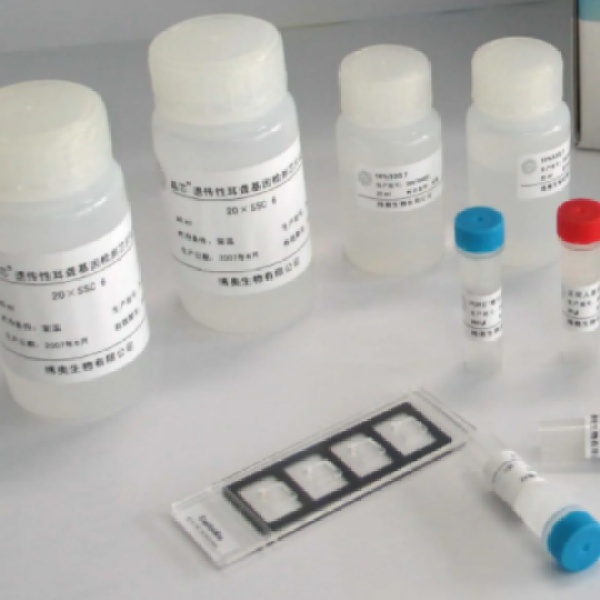大鼠磷酸核糖焦磷酸合成酶(hPRS1)Elisa试剂盒
