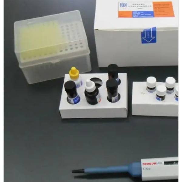 人颗粒溶素抗体(GNLYAb)Elisa试剂盒