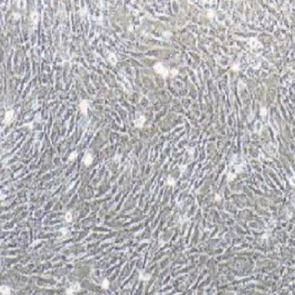 人胃腺癌细胞NCIN87/LUC
