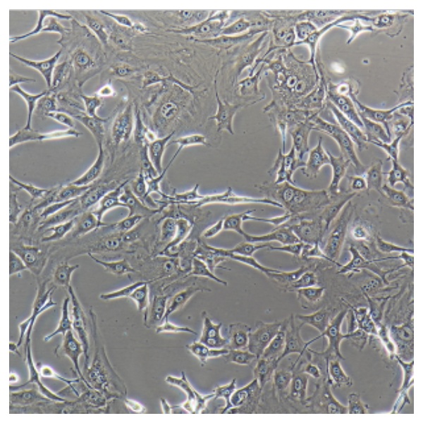 人脑星形胶质瘤细胞SW1783