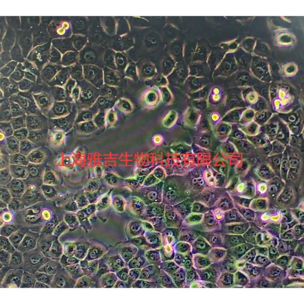 人肝胆管癌细胞SSP25