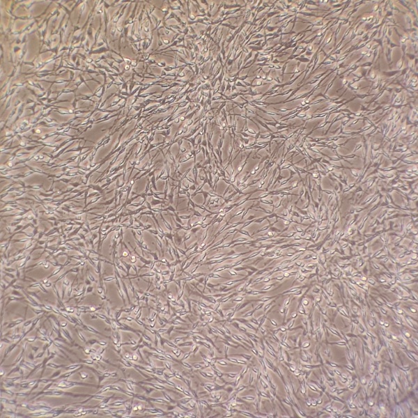 人卵巢癌细胞A1847