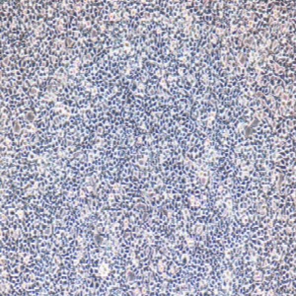 人B淋巴瘤细胞ST486