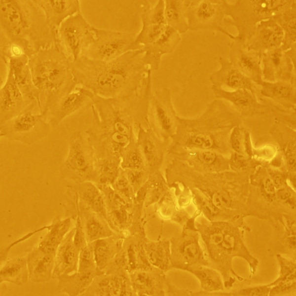 人系膜细胞UM-Chor1
